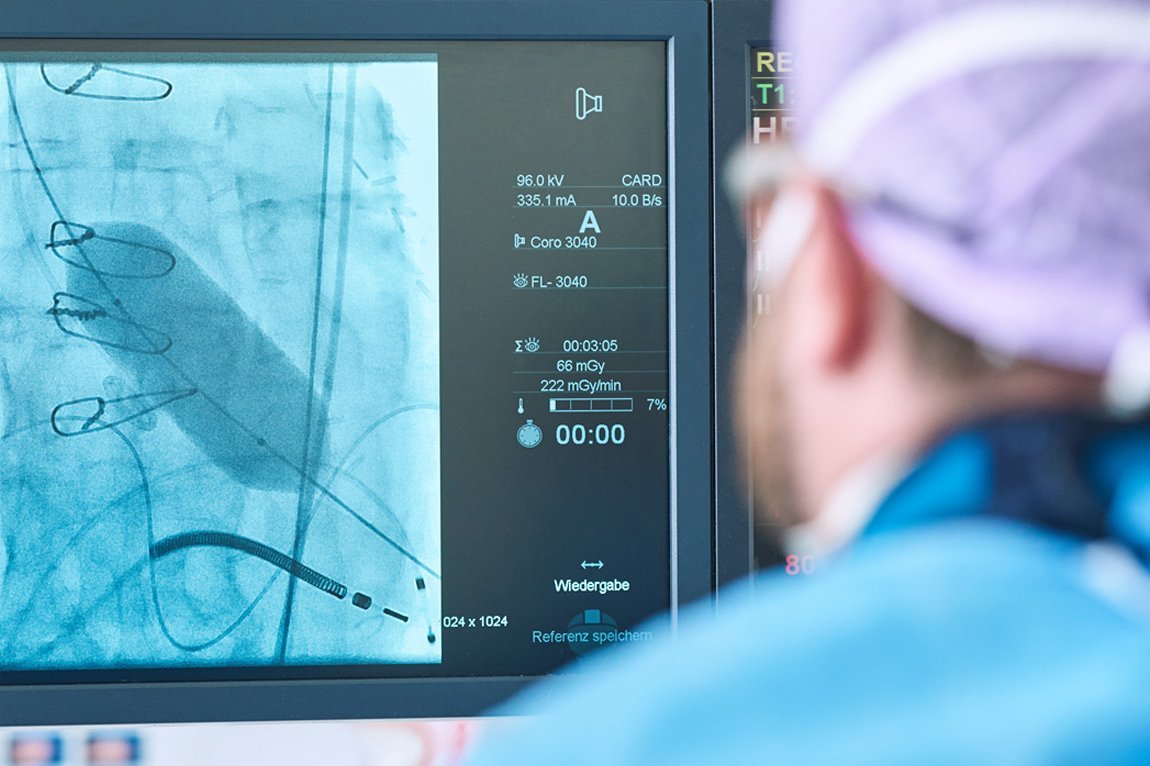 Ein Arzt betrachtet einen Scan auf einem Bildschirm 